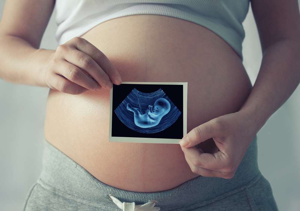 胎児の超音波診断の精度の高さは当科の特徴